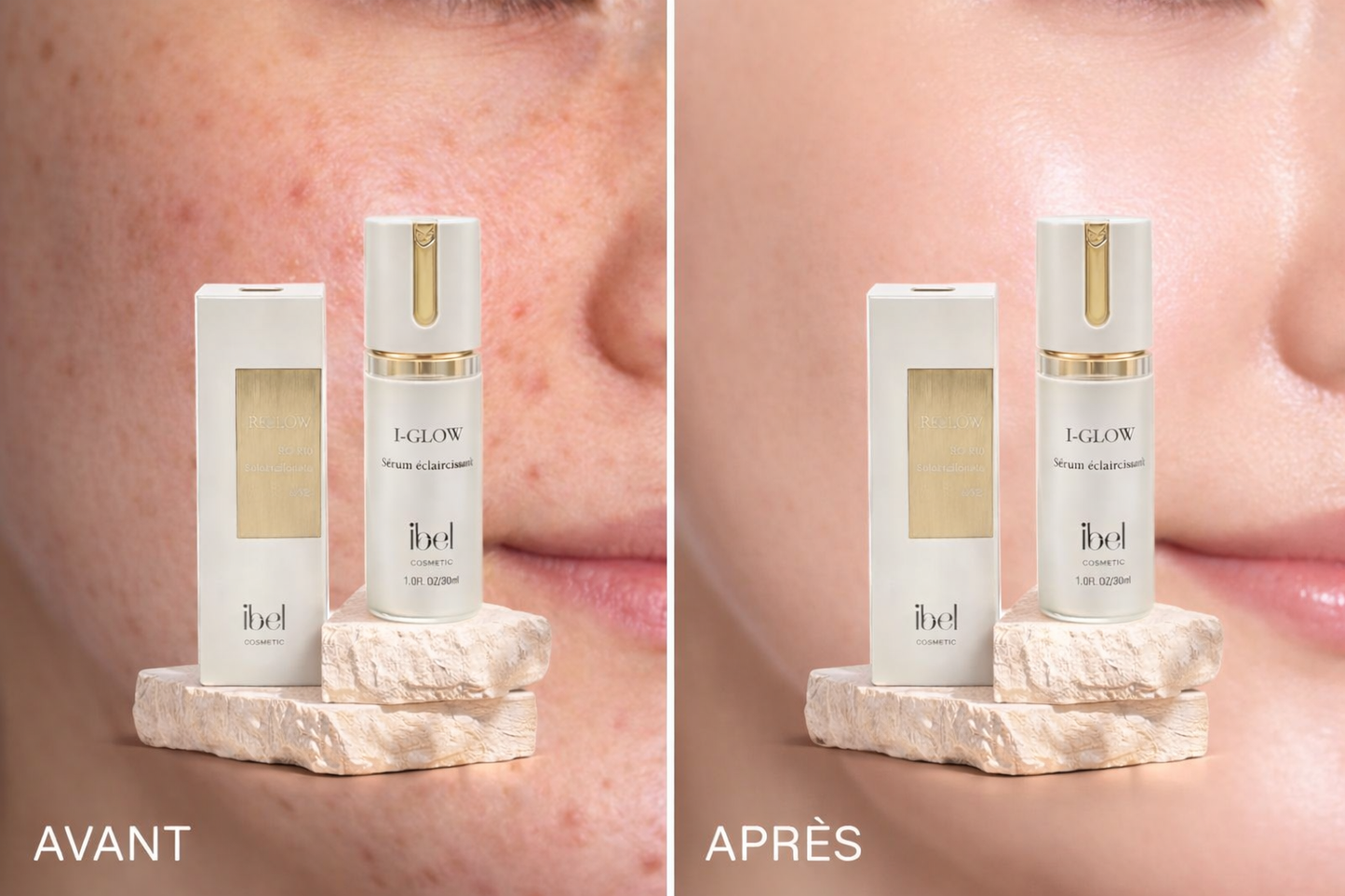 Sérum éclaircissant I-GLOW